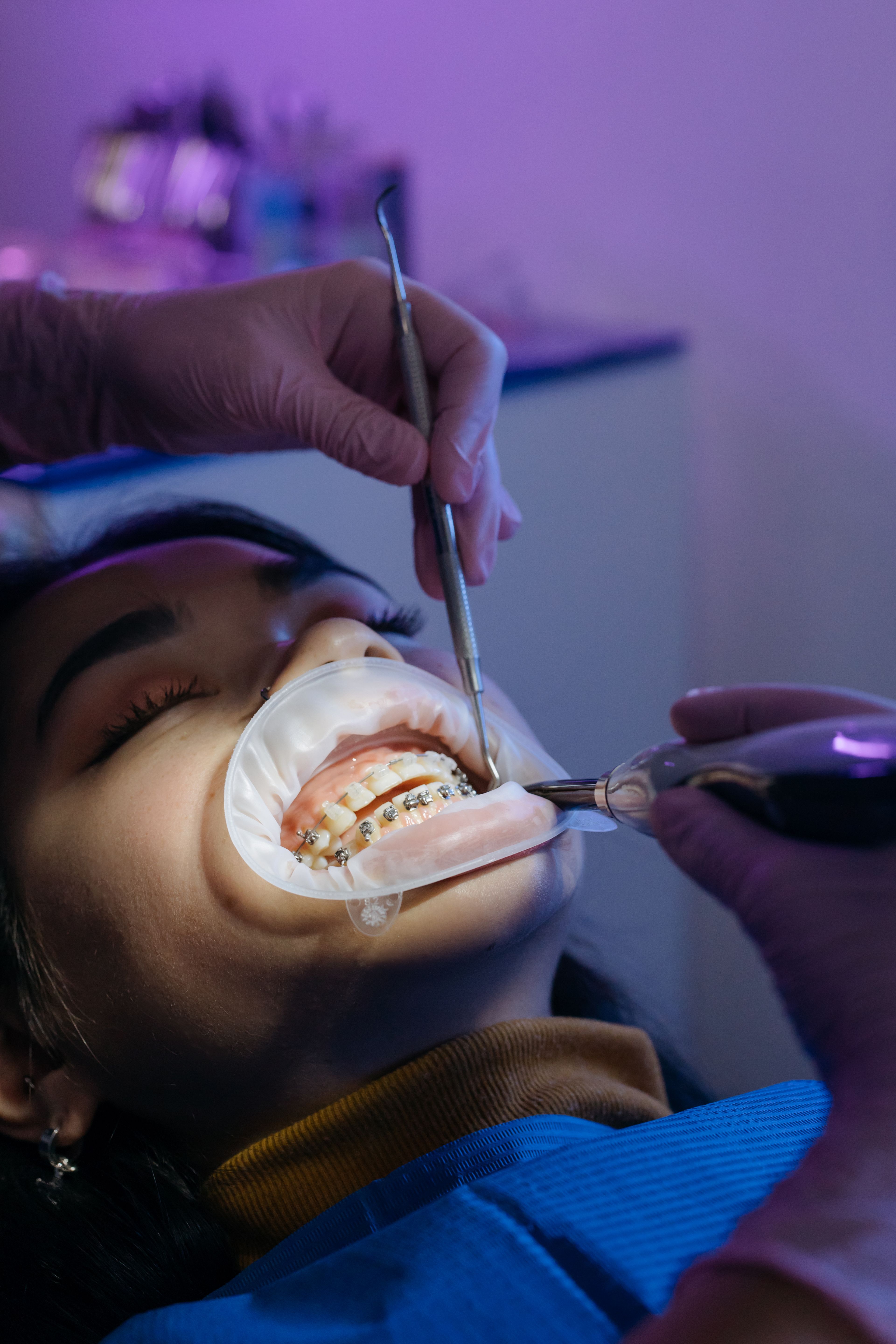 Orthodontic treatment at Azul Dental Center